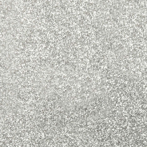 Siser Glitter Silver HTV 20" | Heat Transfer Vinyl
